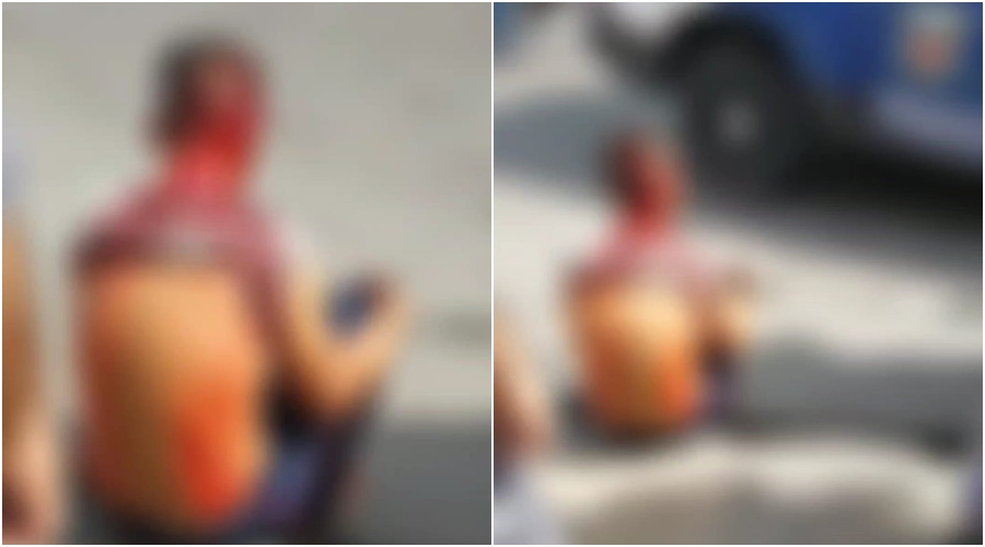 Vídeo: homem tem faca cravada no ouvido