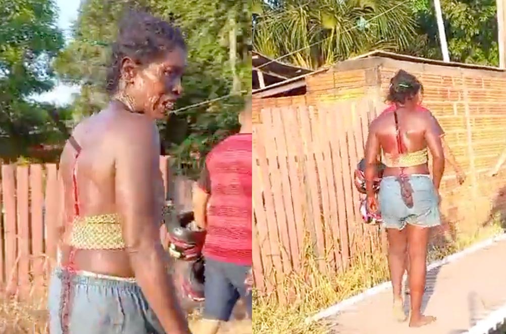 Vídeo: Mulher anda normalmente com faca cravada nas costas