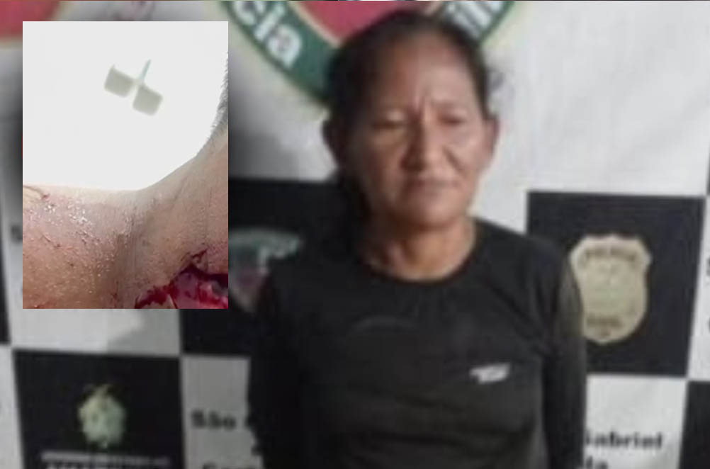 Vídeo: Veja como ficou pescoço de taxista esfaqueado por mulher no Amazonas