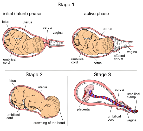 Image showing the stages and progression of labor