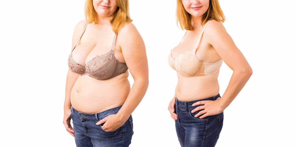 how to get rid of loose skin after weight loss without surgery