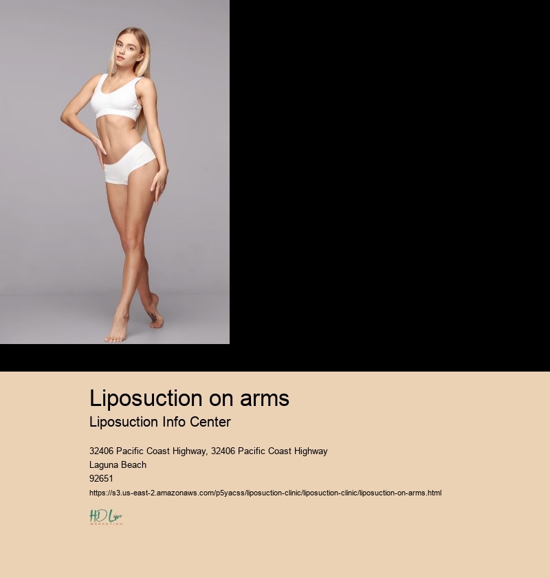 liposuction on arms Liposuction Info Center arm liposuction