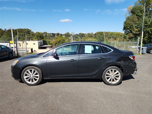 2015 Buick Verano 1SG