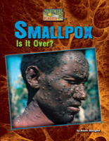 Smallpox