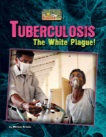Tuberculosis