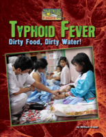 Typhoid Fever