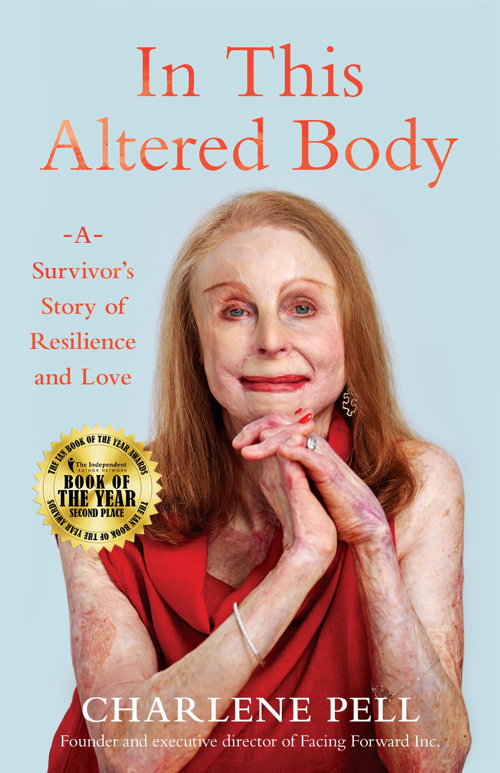 In This Altered Body