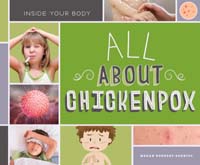 All About Chickenpox