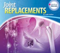 Joint Replacements