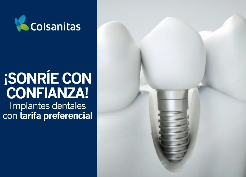 Implantes dentales con 15% de dto. 