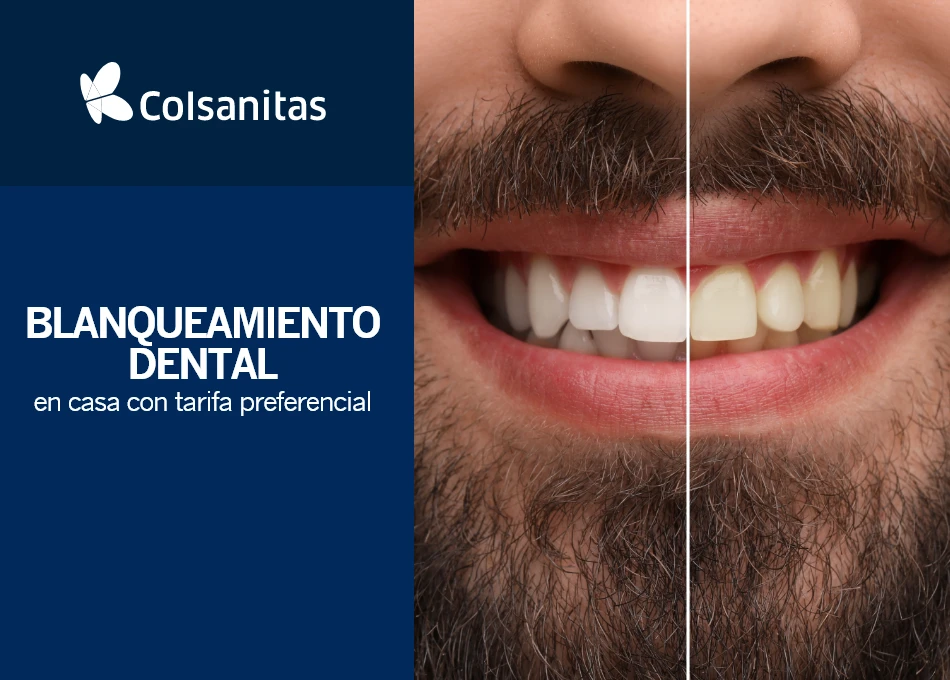 Clinicas dentales - Blanqueamiento Dental en Casa + Fluor saborizado: tarifa preferencial $535.700