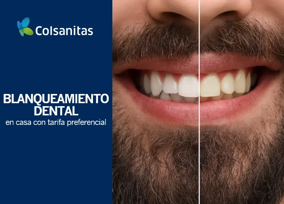 Blanqueamiento Dental en Casa: tarifa preferencial $442.000.