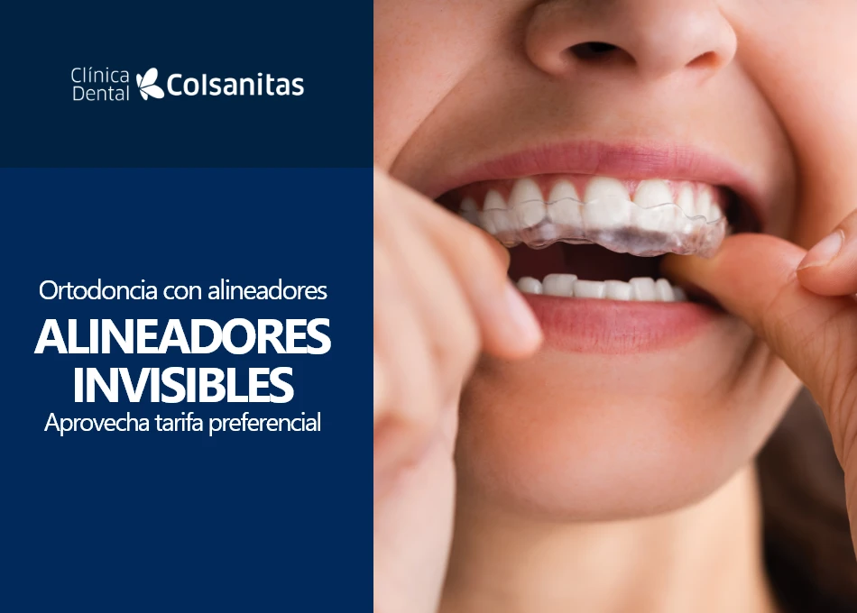 Clinicas dentales - Ortodoncia con alineadores invisibles: tarifa preferencial 13% descuento. 