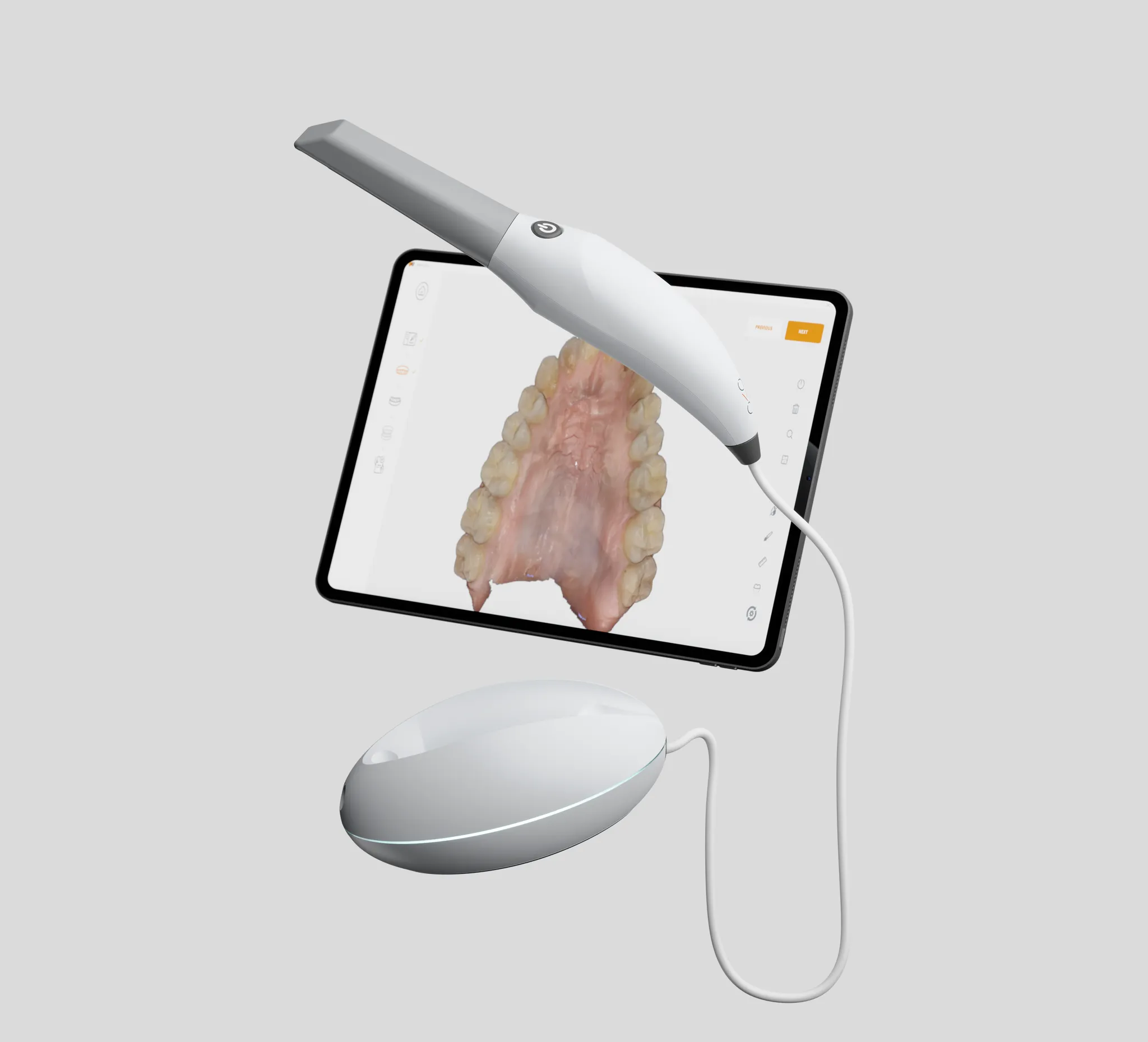 3disc-heron-intraoral-scanner-setup.webp