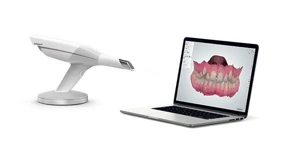 3shape-trios-intraoral-scanner-setup_result.webp
