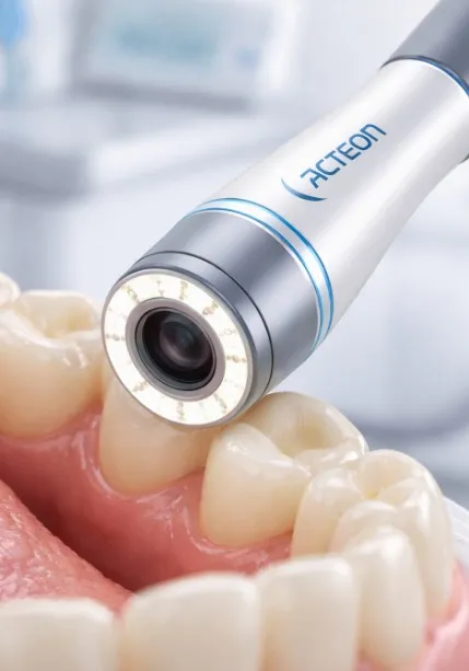 acteon-intraoral-camera-head.webp