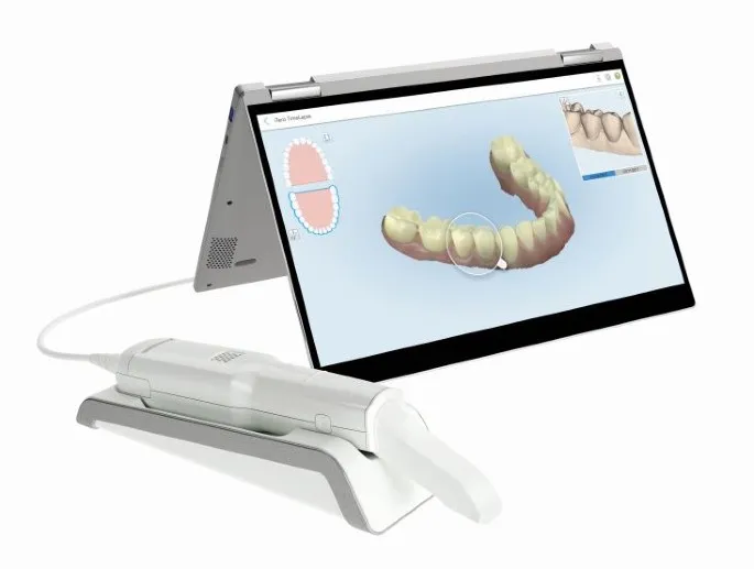 align-itero-intraoral-scanner-in-dental-clinic-close-up-high-resolution-modern-operatory_result.webp