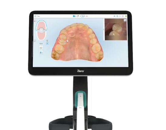 align-itero-intraoral-scanner_result.webp