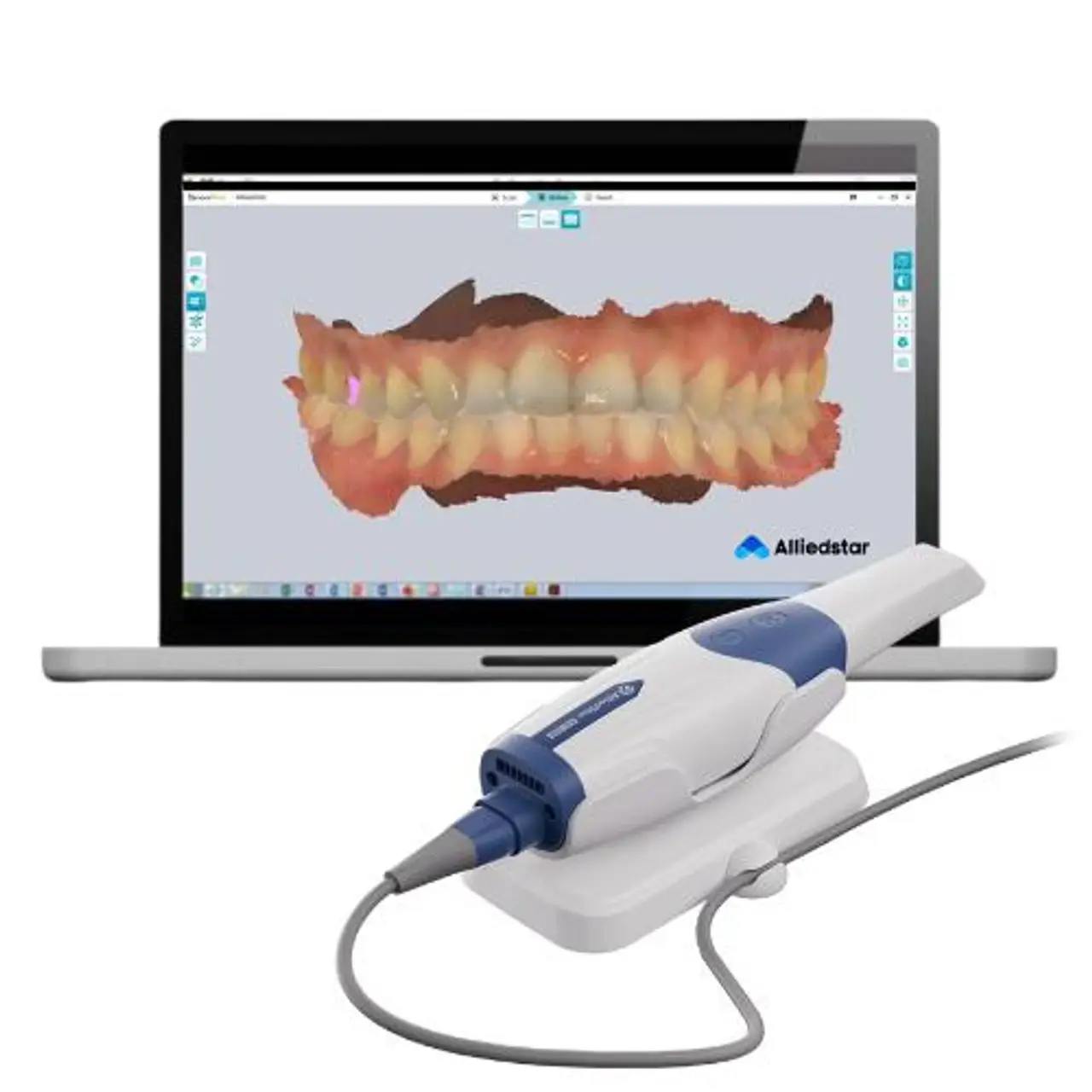 alliedstar-intraoral-scanner-wand-haptic-feedback.webp
