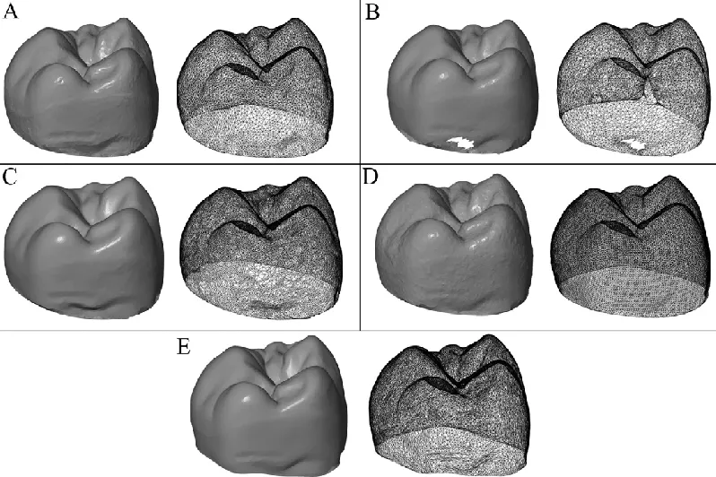 dental-intraoral-scanner-point-cloud-vs-mesh-comparison.webp