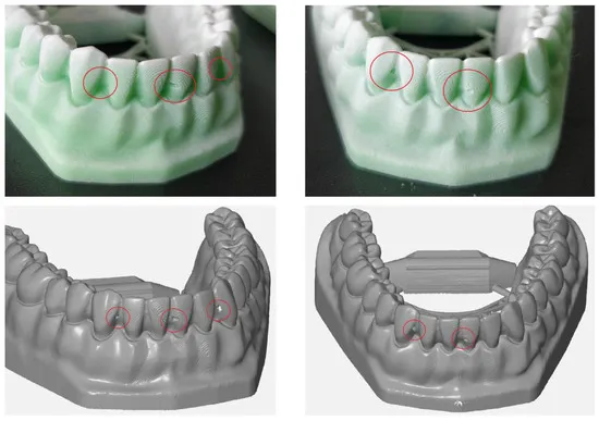 dental-stl-mesh-density-comparison-optimized-vs-unoptimized_result.webp