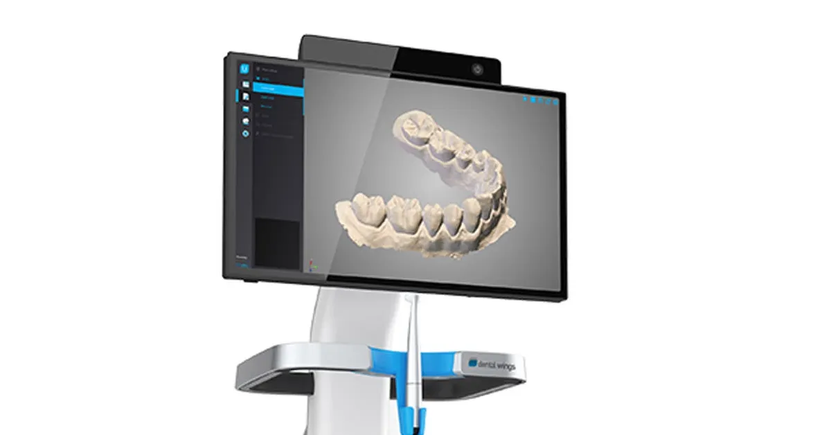 dental-wings-intraoral-scanner-in-use_result.webp