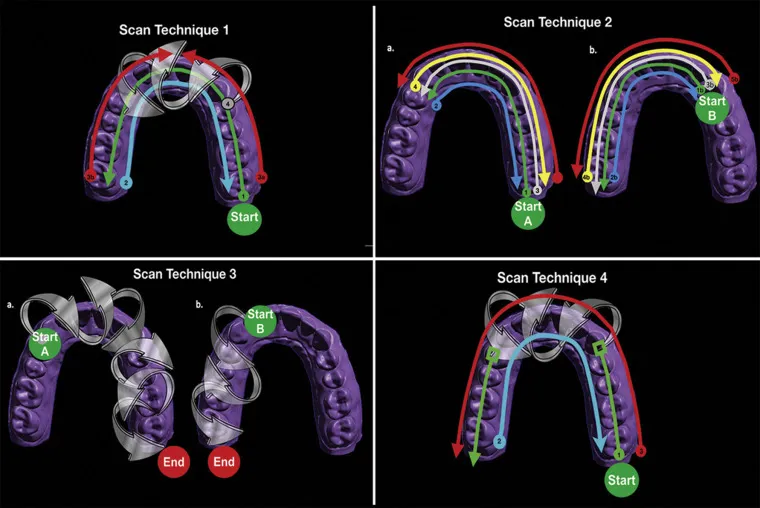 dental-wings-intraoral-scanner.webp