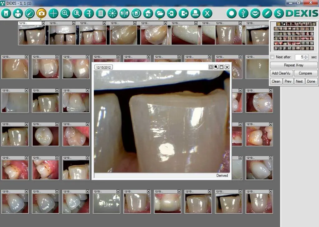 dexis-intraoral-camera-repair.webp