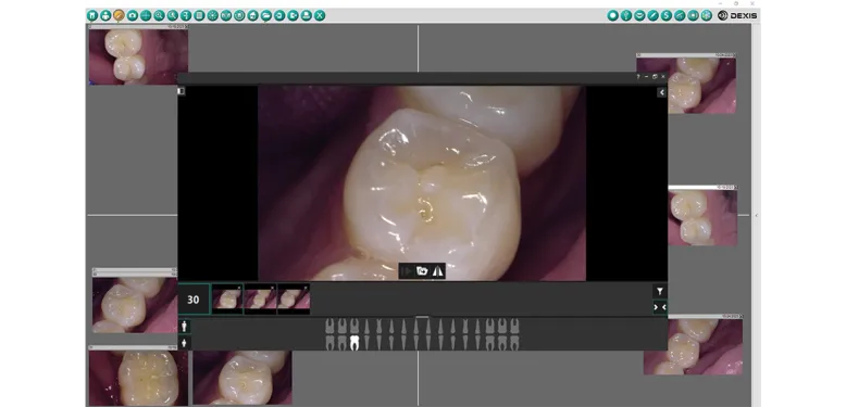 dexis-intraoral-cameras-focuses-on-reducing-latency-for-smoother-real-time-clinical-imaging._result.webp