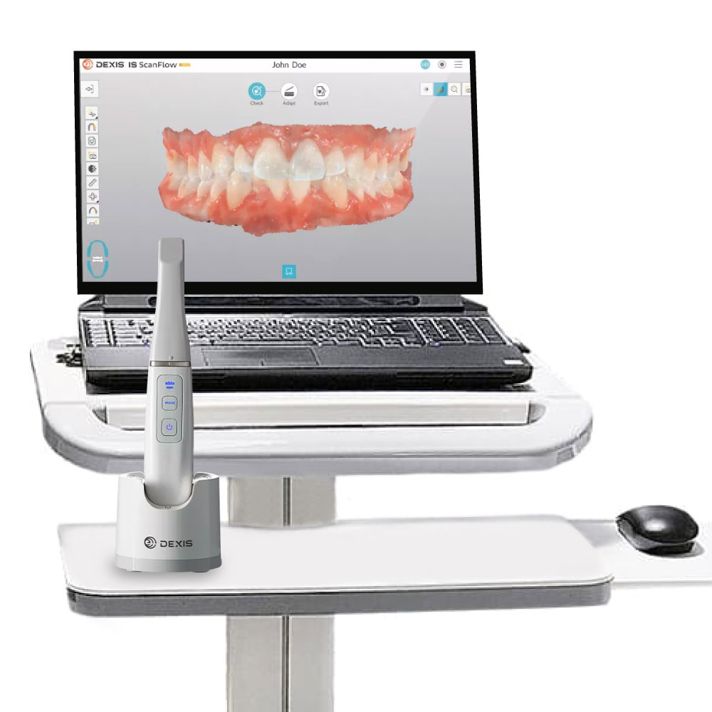 dexis-intraoral-scanners-laptop-cart-trolley-1.jpg