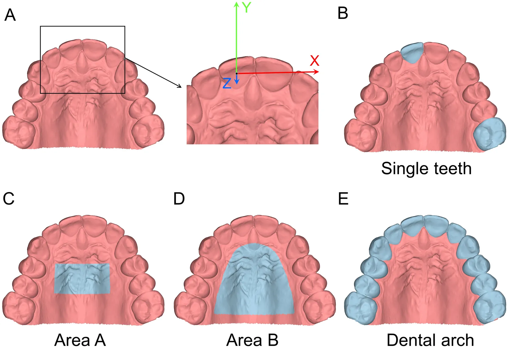 intraoral-scanner-mesh-generation-error-surface-distortion.webp