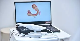 intraoral-scanner-real-time-scanning-performance-dental-clinic.webp