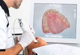 intraoral-scanner-wand-crack-propagation-testing-laboratory_result.webp