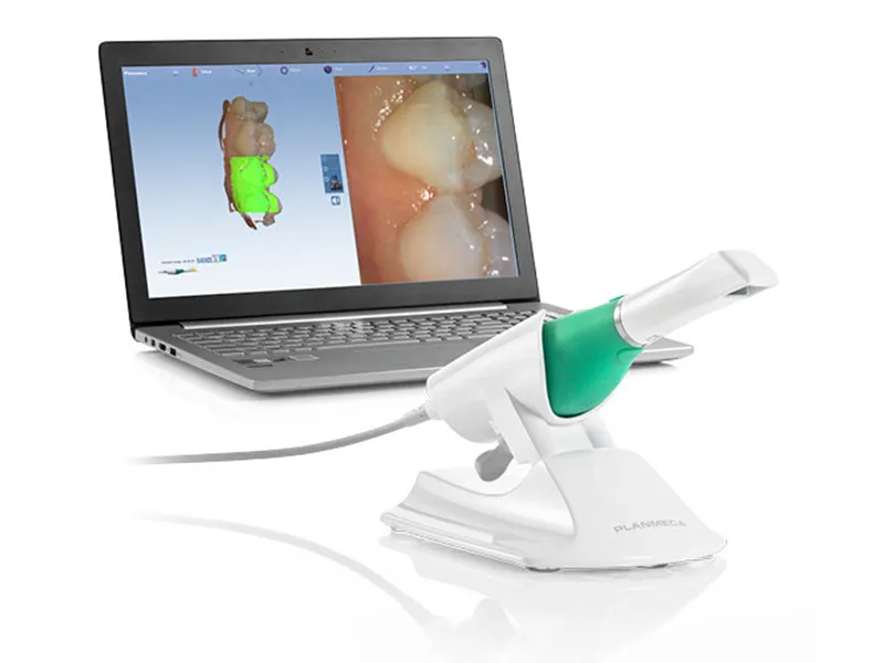 planmeca-dental-scanner_result.webp