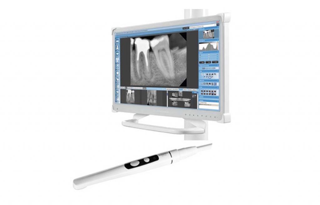 planmeca-intraoral-camera.jpg