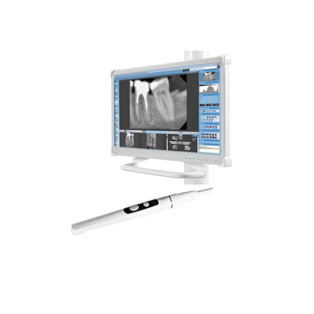 planmeca-intraoral-camera.webp