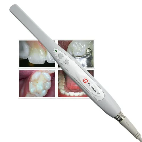 schick-intraoral-camera.webp