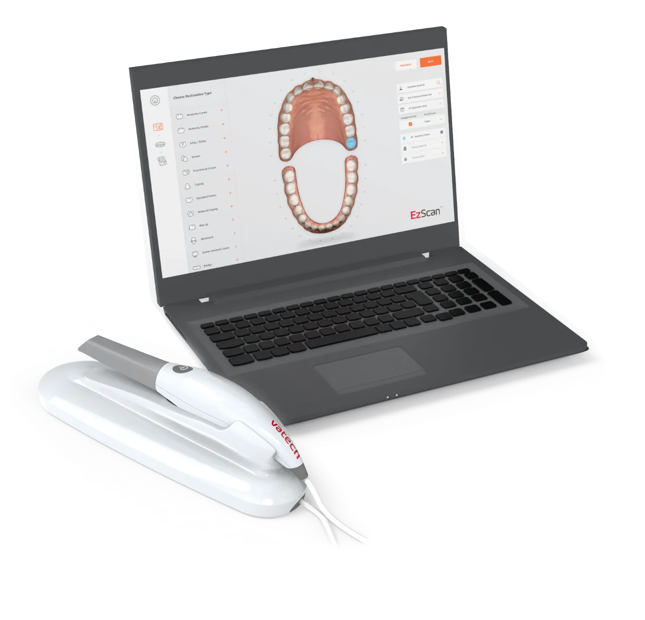 vatech-intraoral-scanner_result.webp