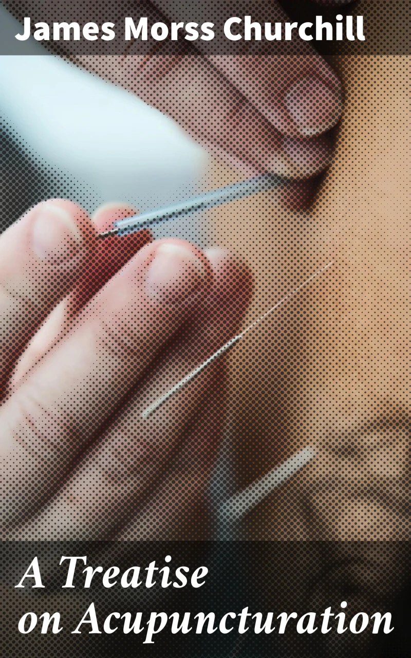 Portada: A Treatise on Acupuncturation