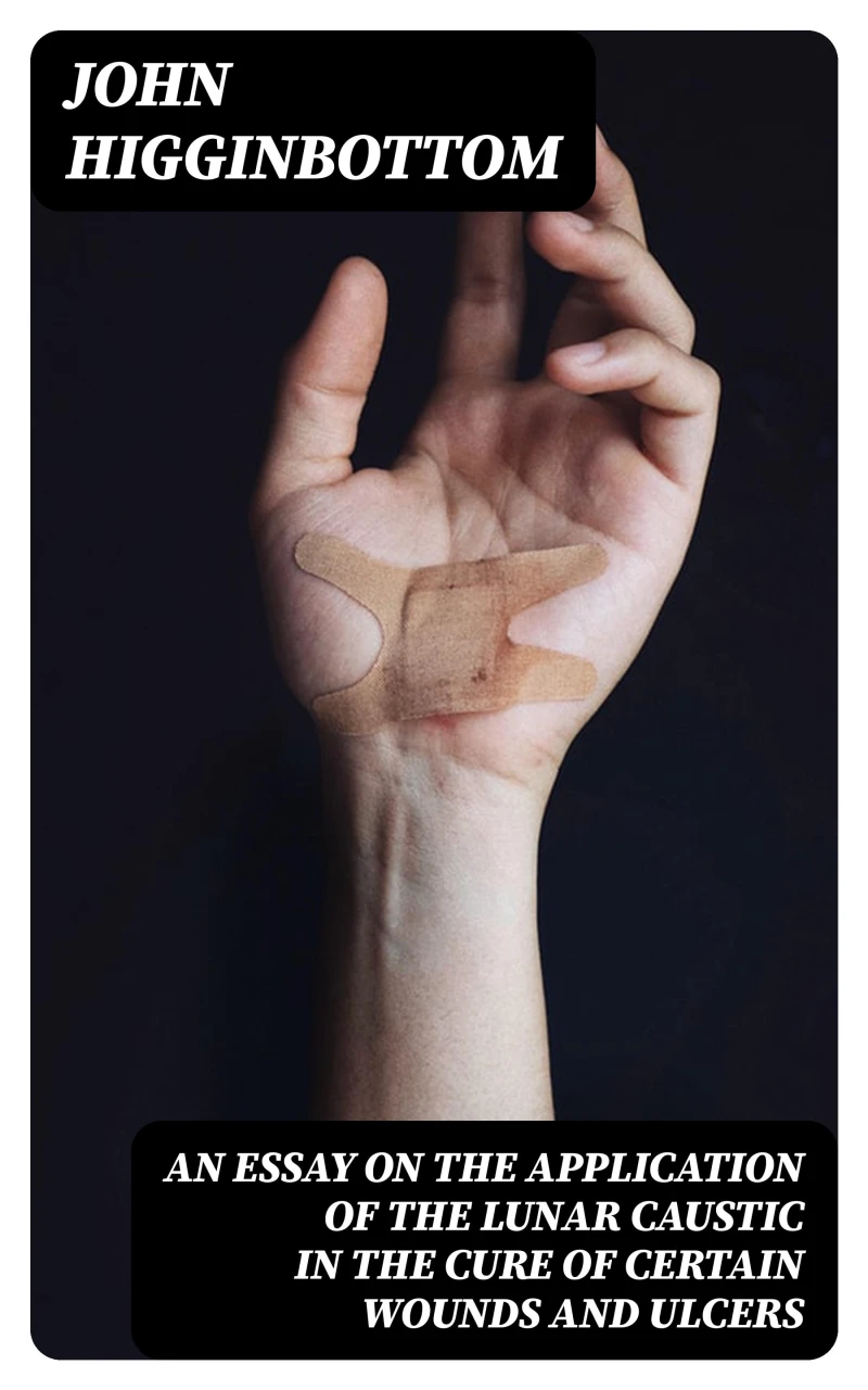 Portada: An Essay on the Application of the Lunar Caustic in the Cure of Certain Wounds and Ulcers