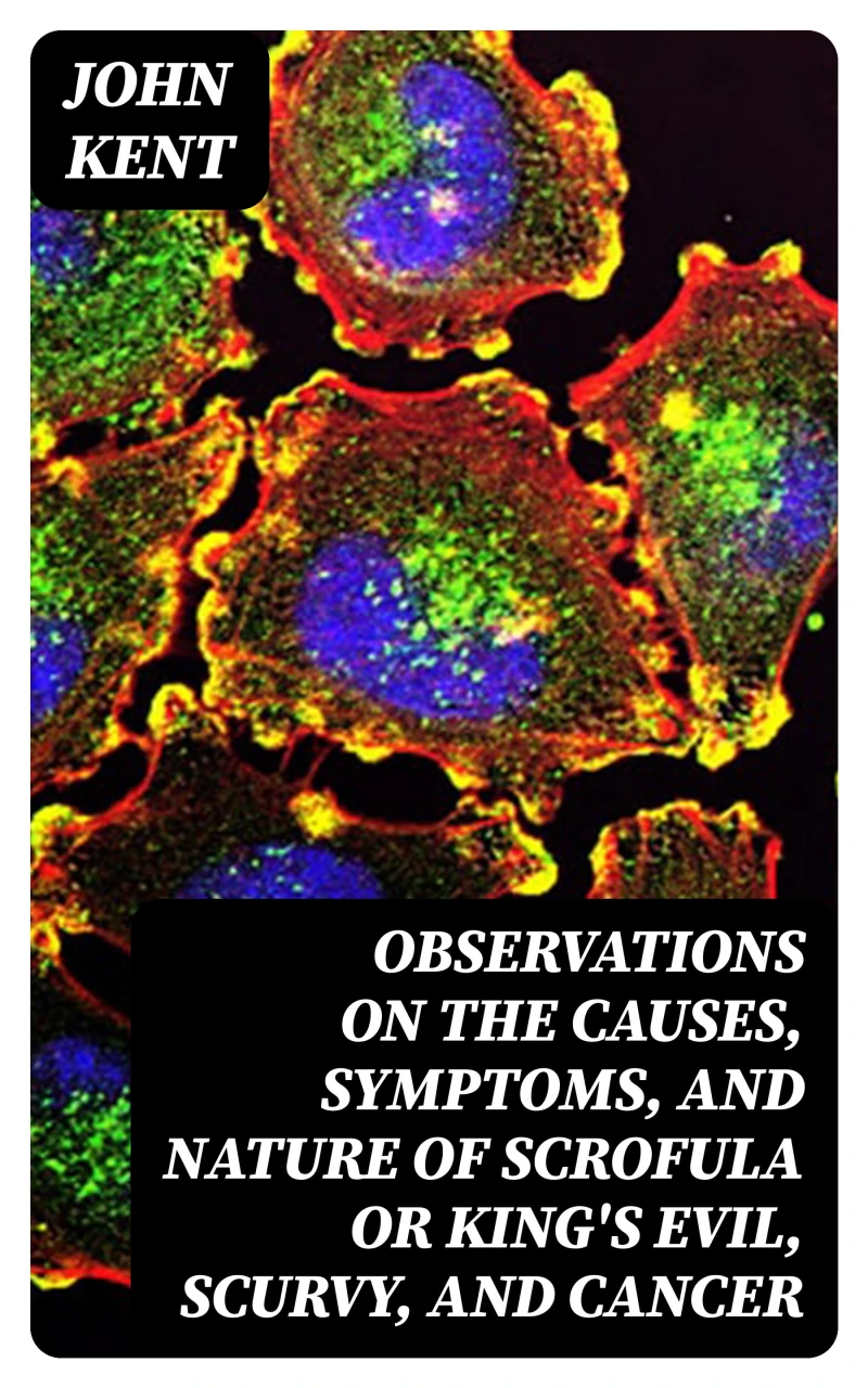Portada: Observations on the Causes, Symptoms, and Nature of Scrofula or King's Evil, Scurvy, and Cancer