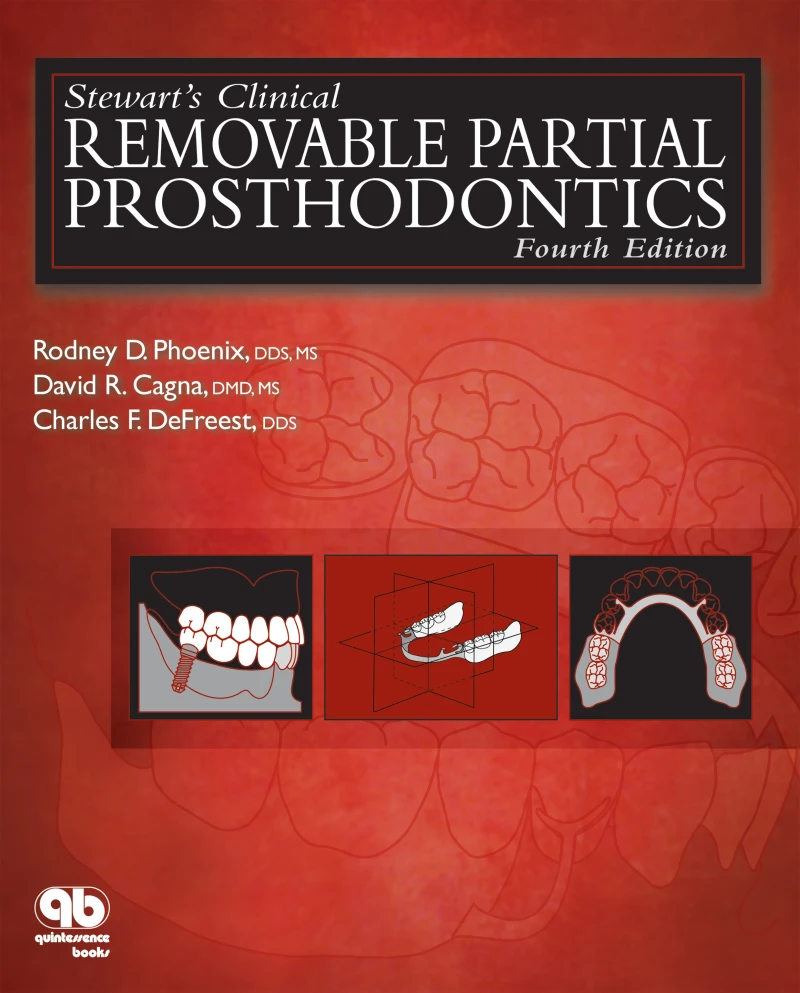 Portada: Stewart's Clinical Removable Partial Prosthodontics