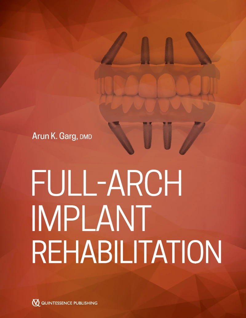 Portada: Full-Arch Implant Rehabilitation
