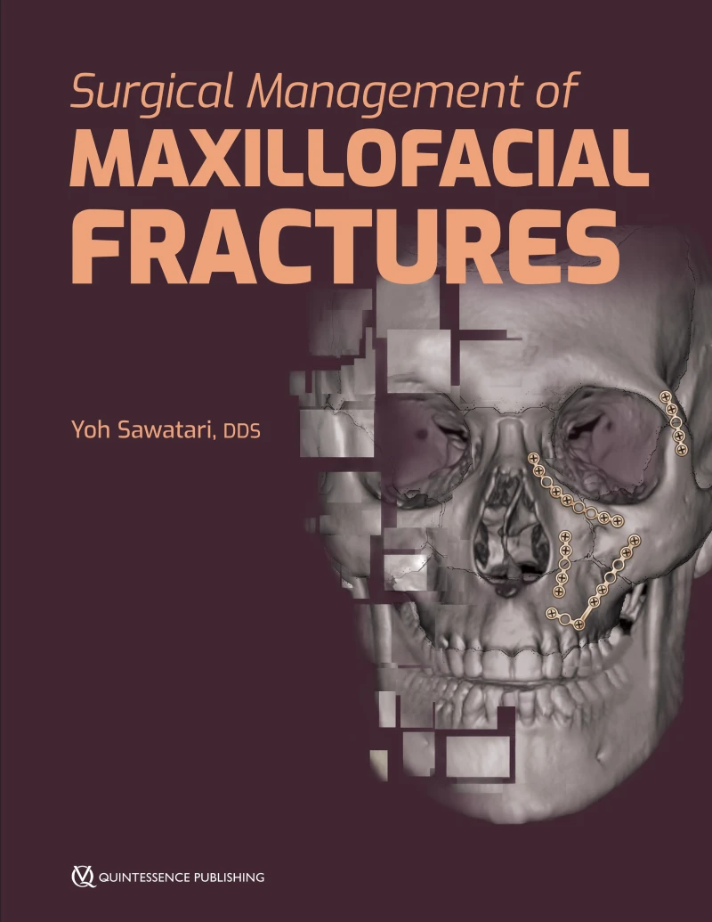 Portada: Surgical Management of Maxillofacial Fractures