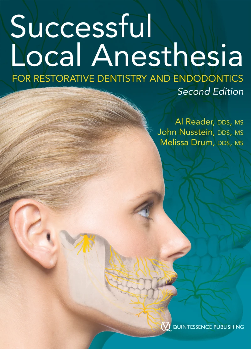 Portada: Successful Local Anesthesia for Restorative Dentistry and Endodontics