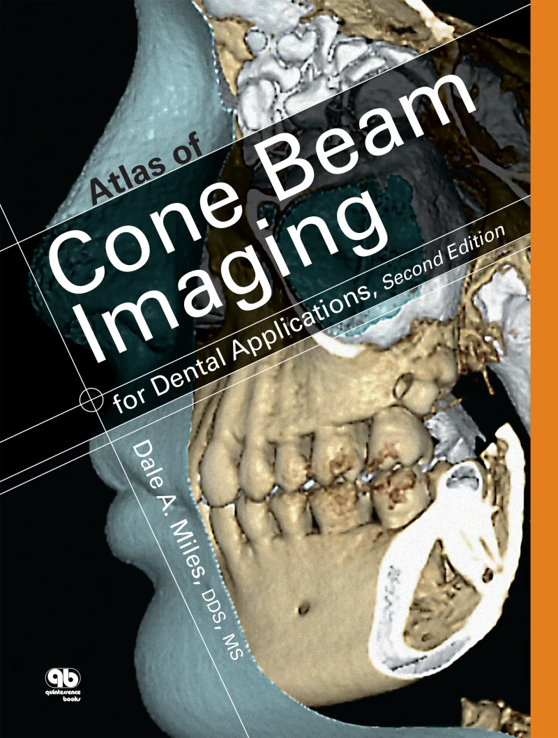 Portada: Atlas of Cone Beam Imaging for Dental Applications