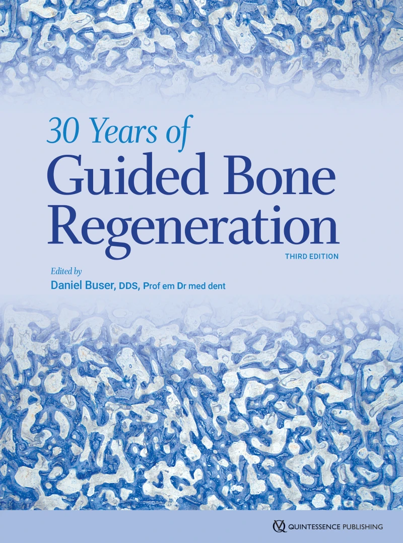 Portada: 30 Years of Guided Bone Regeneration