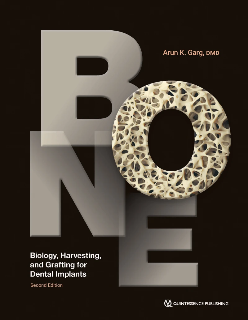 Portada: Bone