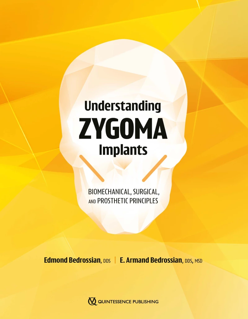 Portada: Understanding Zygoma Implants