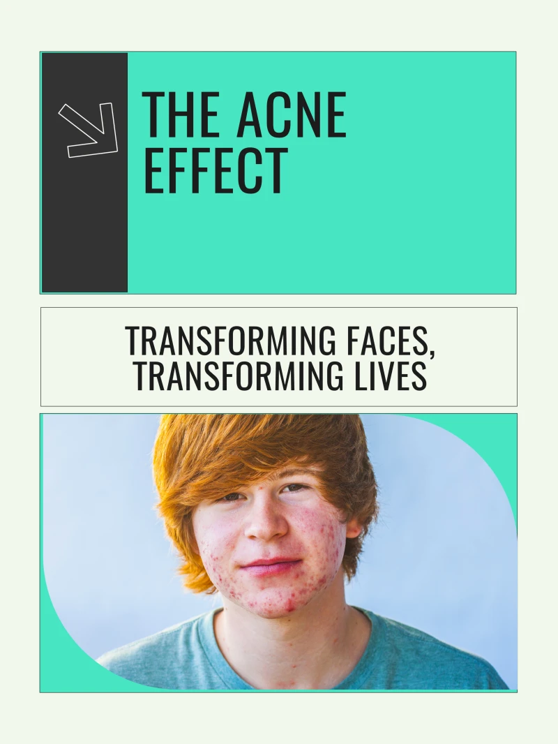 Portada: The Acne Effect